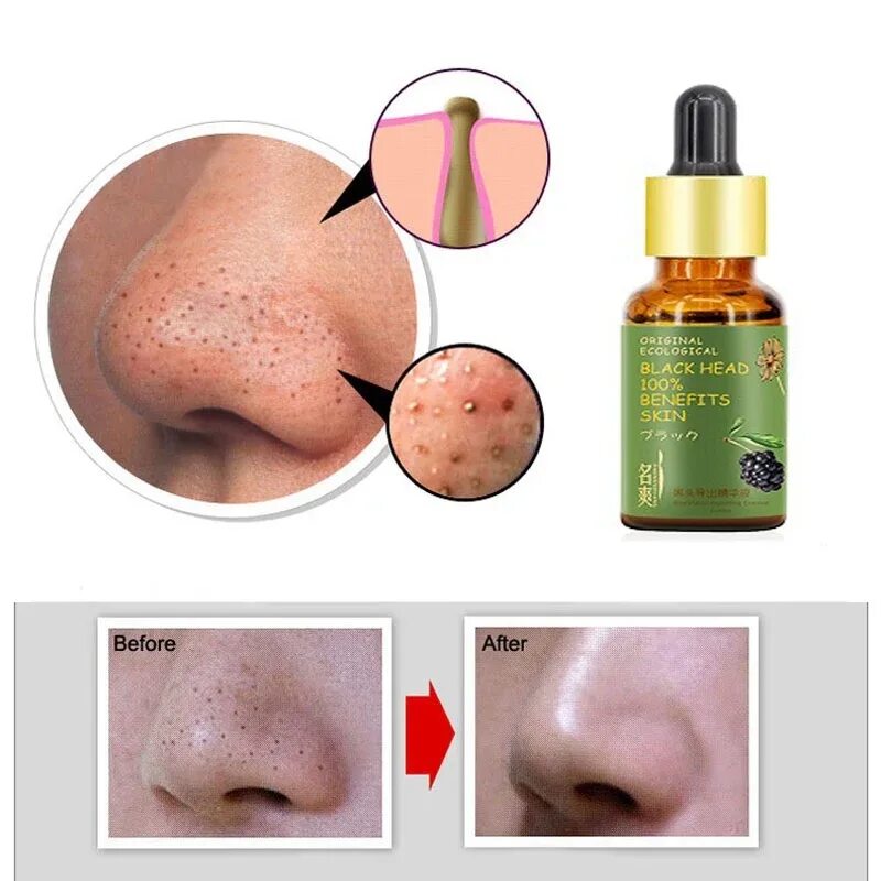 для сужения пор на лице средство лучшее. Bioderma концентрат для сужения пор sebium pore refiner. поросуживающие средства для лица. для сужения пор на лице средство лучшее. для сужения пор на лице средство лучшее.