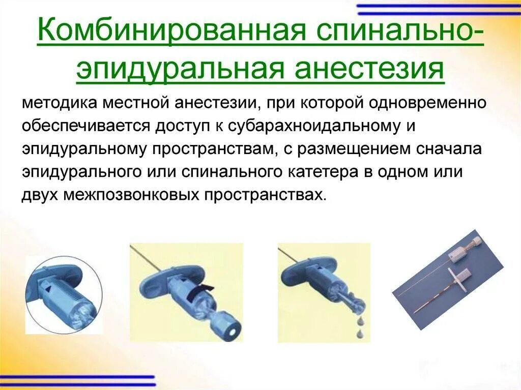 Эпидуральная спинная. Комбинированная спинально-эпидуральная анестезия. Спинальная и эпидуральная анестезия. Разница спинальной и эпидуральной анестезии. Эпидуральная и спинномозговая анестезия различия.