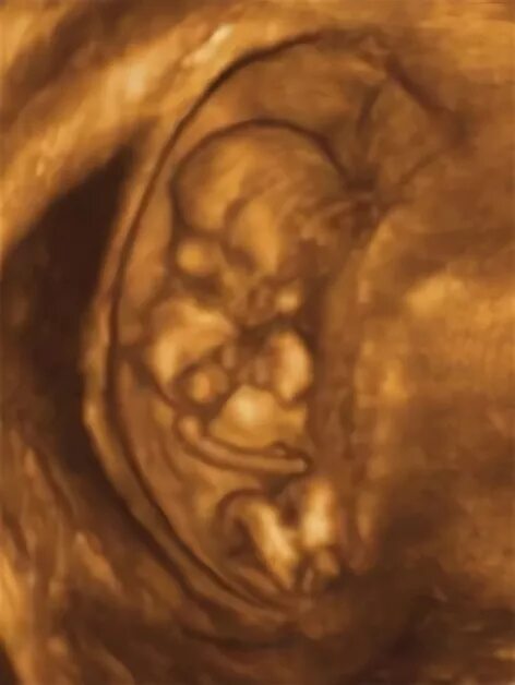 Pin on Baby Development Week by Week