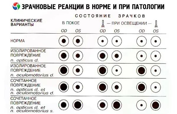Реакция на свет норма