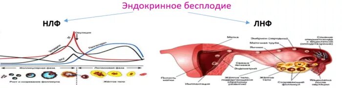 Эндокринный фактор бесплодия. Причины эндокринного бесплодия. Эндокринные причины бесплодия у женщин. Без бесплодие