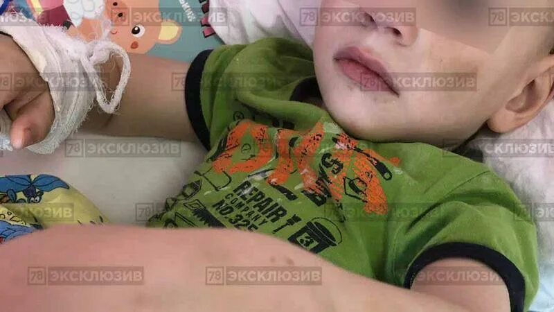 Петербург избил ребенка. Мужик сломал руку мальчику на площадке. Петербурге мужчина избил семью. Банда подростков избила. Банда подростков избила.