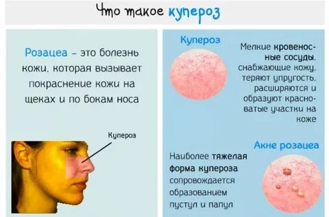 Что означает прыщ на носу приметы