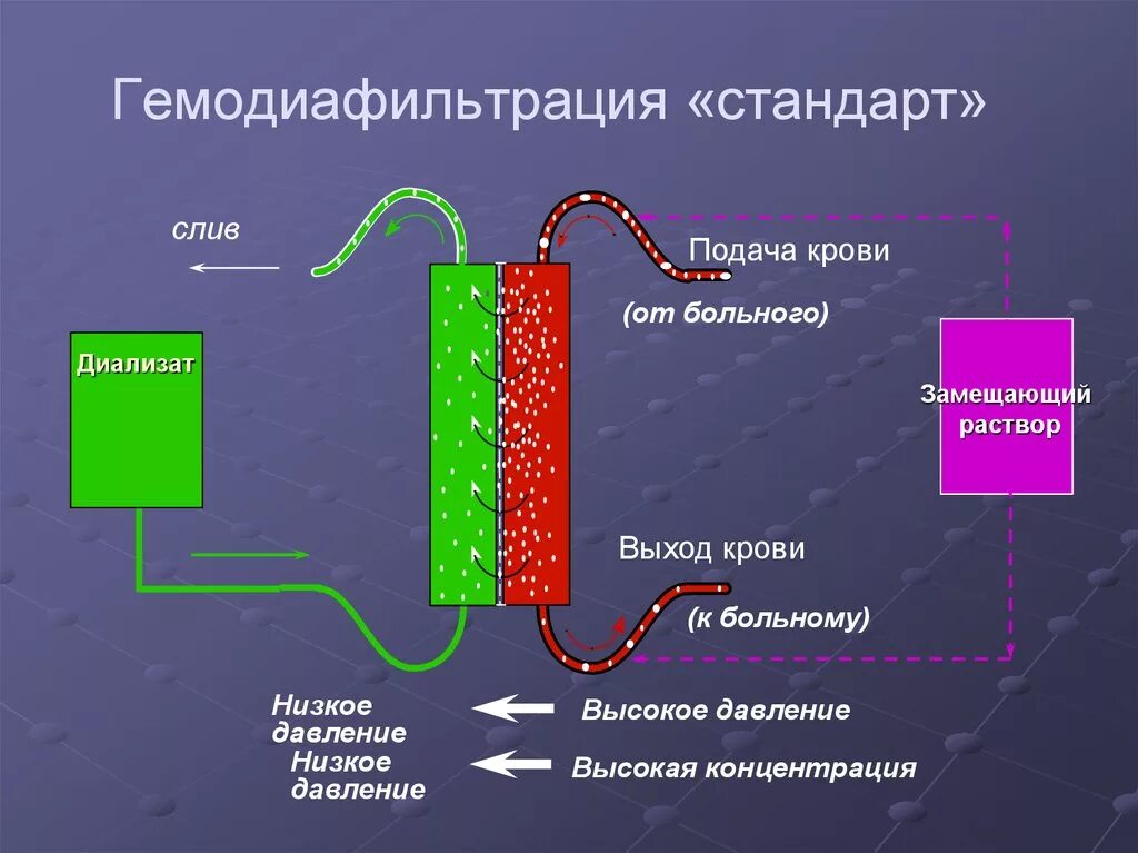 Ультрафильтрация диализ