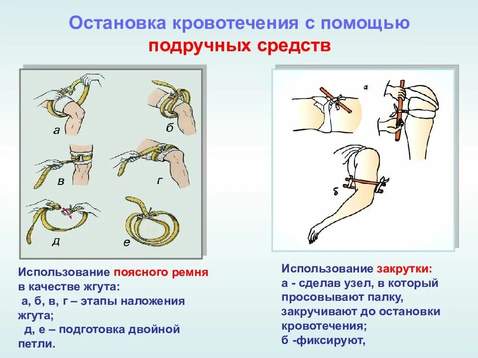 Правила и последовательность наложения жгута. Виды наложений кровиостанавливающих жгутов. Техника наложения кровоостанавливающего жгута. Способы применения жгута. Методика наложения кровоостанавливающего жгута.