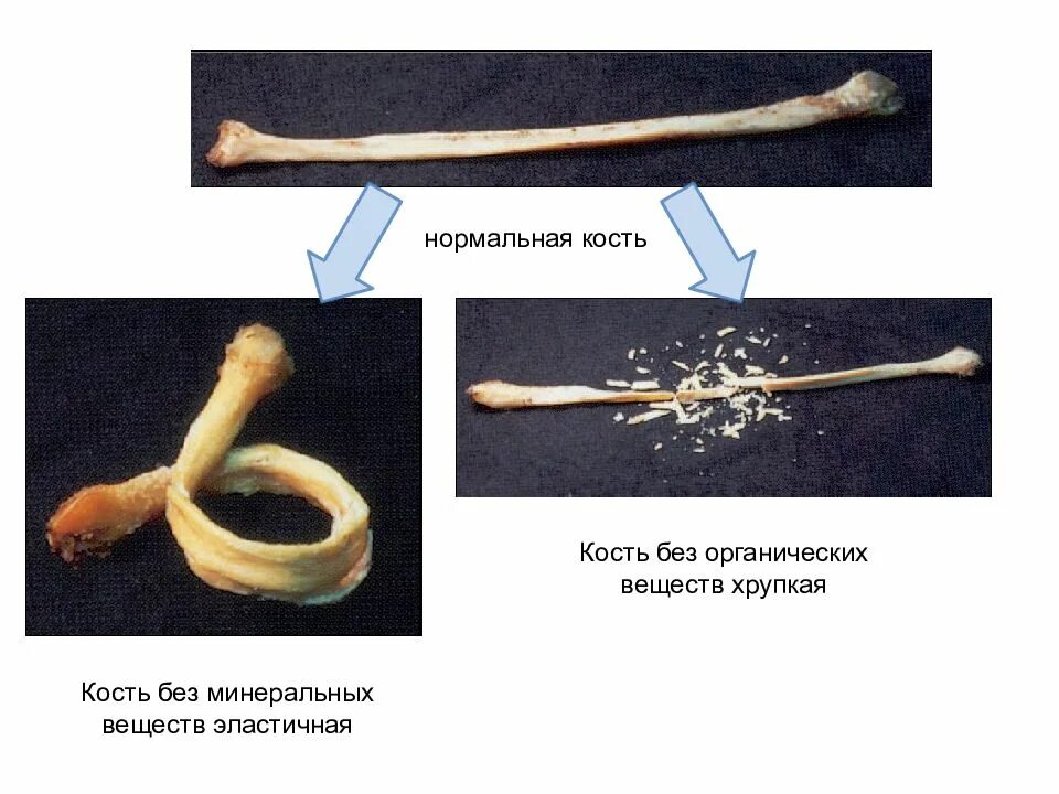 Кости сгорают. Кость без Минеральных веществ. Декальцинированная кость. Декальцинированная и прокаленная кость. Органич вещества кости.