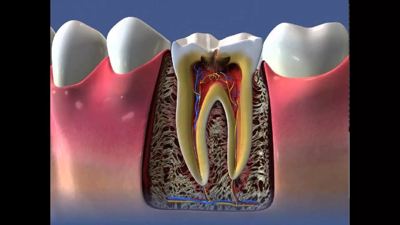 Почему открывают зуб. Кариес пульпит периодонтит.