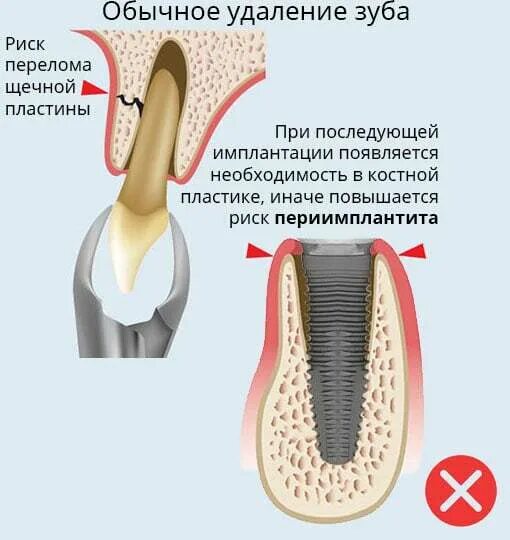 Удалить какой корень. Удалить какой корень