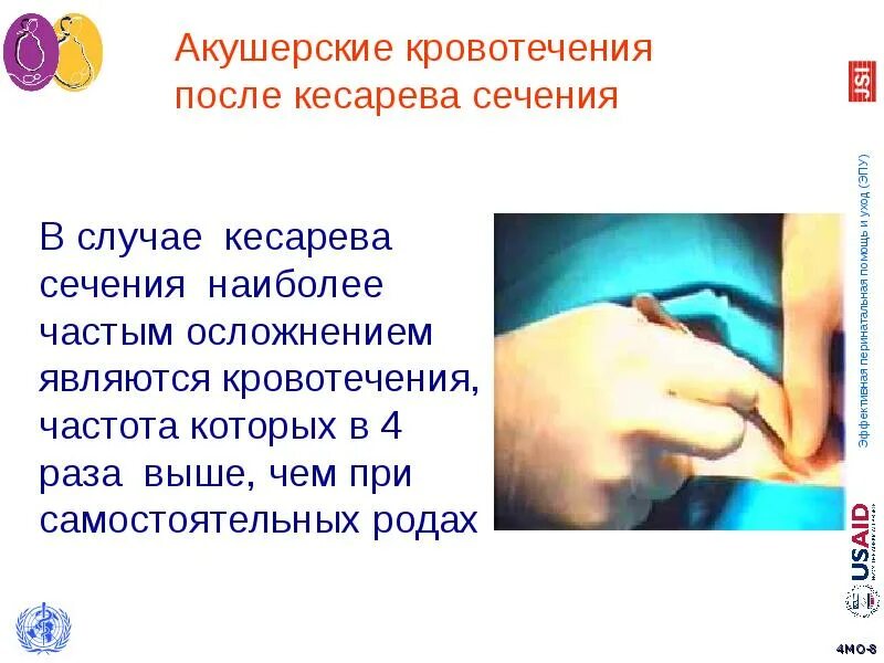 Сколько дней идет кровотечение после. Кровотечение после кесарева. кровотечение после кесарева сечения. осложнений после кесарева кровотечение. выделения после кесарева сечения.