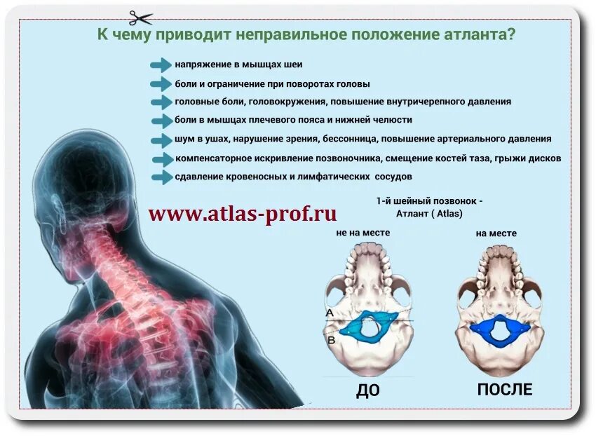 Болит шея и поднимается давление