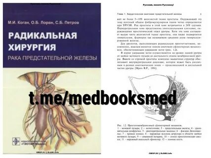 Предстательная железа периуретральные железы