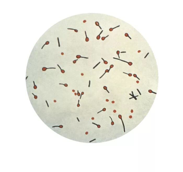 Clostridium spp. Клостридия тетани микробиология. Clostridium pasteurianum. Клостридия тетани ,мазок по Граму. Clostridium botulinum микроскоп.