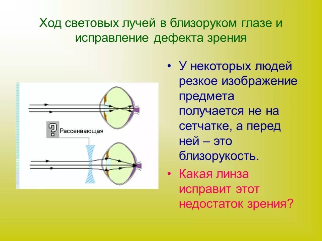 Ход лучей глаза человека. Близорукость ход лучей в глазе. Ход лучей в близоруком глазу. Ход лучей близорукость и дальнозоркость. Ход лучей в оптической системе глаза близорукость.