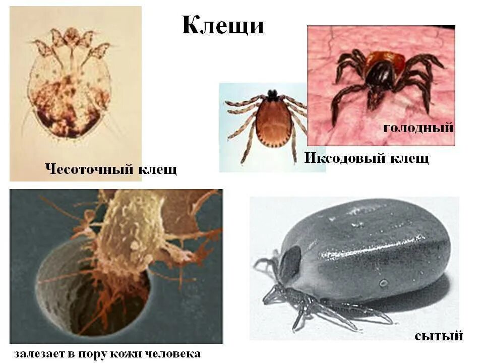 Интересные факты о педикулезе. Внешнее и внутреннее строение паука. К классу паукообразные относится домашний клоп. Таежный клещ систематика. К классу паукообразные относится домашний клоп.