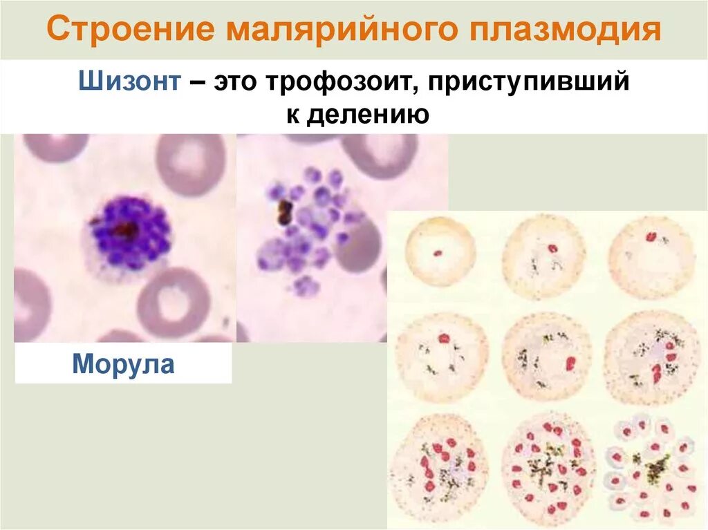 Морфология плазмодия малярии. Малярийный плазмодий стадия амебовидного шизонта. Малярия шизонт. Шизонт малярийного плазмодия. Микрогаметоцит это