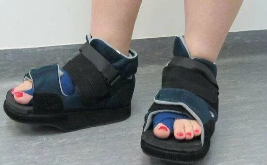 Вальгус какую обувь. Обувь после операции халюс вальгус. Обувь барука после операции вальгус. Ортопедическая обувь после операции халюс вальгус. Ортопедическая обувь обувь после операции на вальгус.