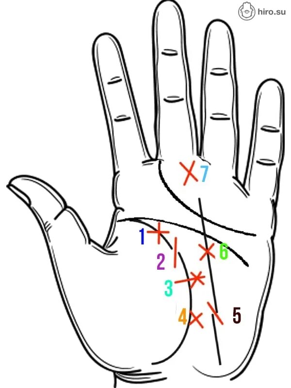Кресты на руке хиромантия. Крест на линии жизни. Крестик на линии жизни. Знаки аварии на ладони. Знаки катастрофы на руке хиромантия.