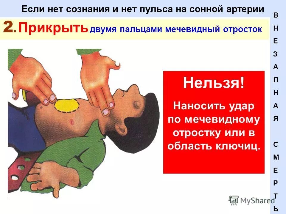 Если нет сознания и нет пульса. Нет сознания и пульса на сонной артерии. Нет сознания нет пульса. 1 помощь если есть пульс но нет сознания. Действия при отсутствии сознания и пульса на сонной артерии.