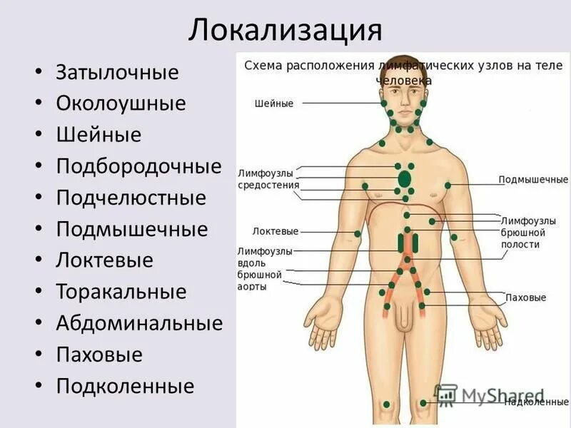 Периферические лимфатические узлы схема. Лимфоузлы паховые где находятся схема. Увеличены лимфоузлы расположение. Лимфоаденопатия (увеличение лимфатических узлов).. Где у женщины расположены лимфоузлы