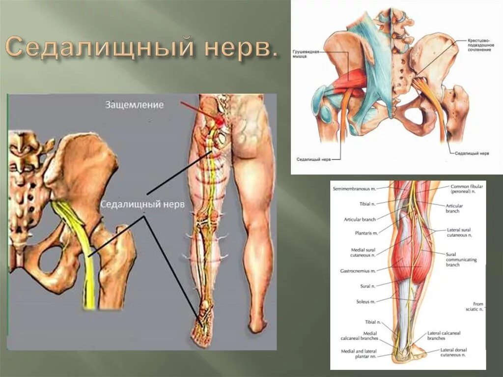 Грушевидной мышцы форум. Седалищный нерв. седалищный нерв анатомия. схема прохождения седалищного нерва. седалищный нерв анатомия мышцы.