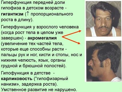 Гиперфункция