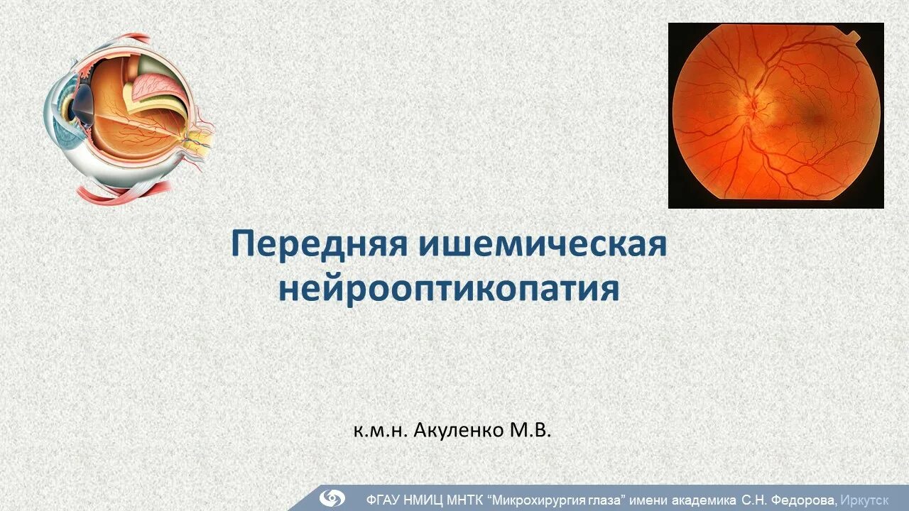 Флуоресцентная ангиография сетчатки глаза. Передняя ишемическая нейропатия. Нейроофтальмология учебник. Передняя ишемическая нейрооптикопатия. Передняя ишемическая нейрооптикопатия.