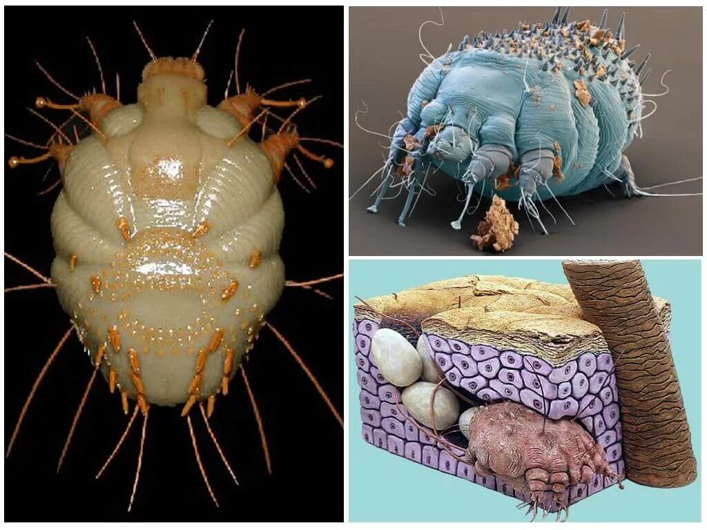 Сколько живет чесоточный. Чесоточный клещ чесотка. Чесоточный клещ Sarcoptes scabiei. Чесоточный зудень (Sarcoptes scabiei).