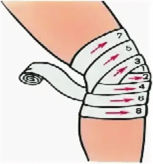 Забинтовать колено эластичным. Циркулярная повязка на колено. Повязка на коленный сустав бинтом. Бинтование коленного сустава эластичным бинтом. Наложить эластичный бинт на колено.