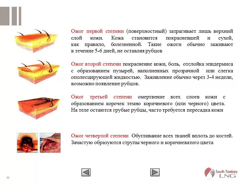 4 Стадия ожогах первая помощь.