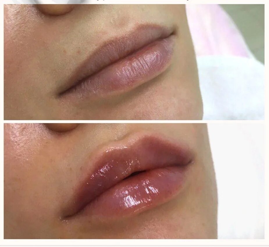 Губы арка. Губы арка. Перманент губ арка купидона. Форма губ без арки купидона. Увеличение губ арка купидона.