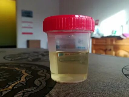 Как собрать мочу у кошки для анализа Зверополис. Ольга Шильцова Дзен