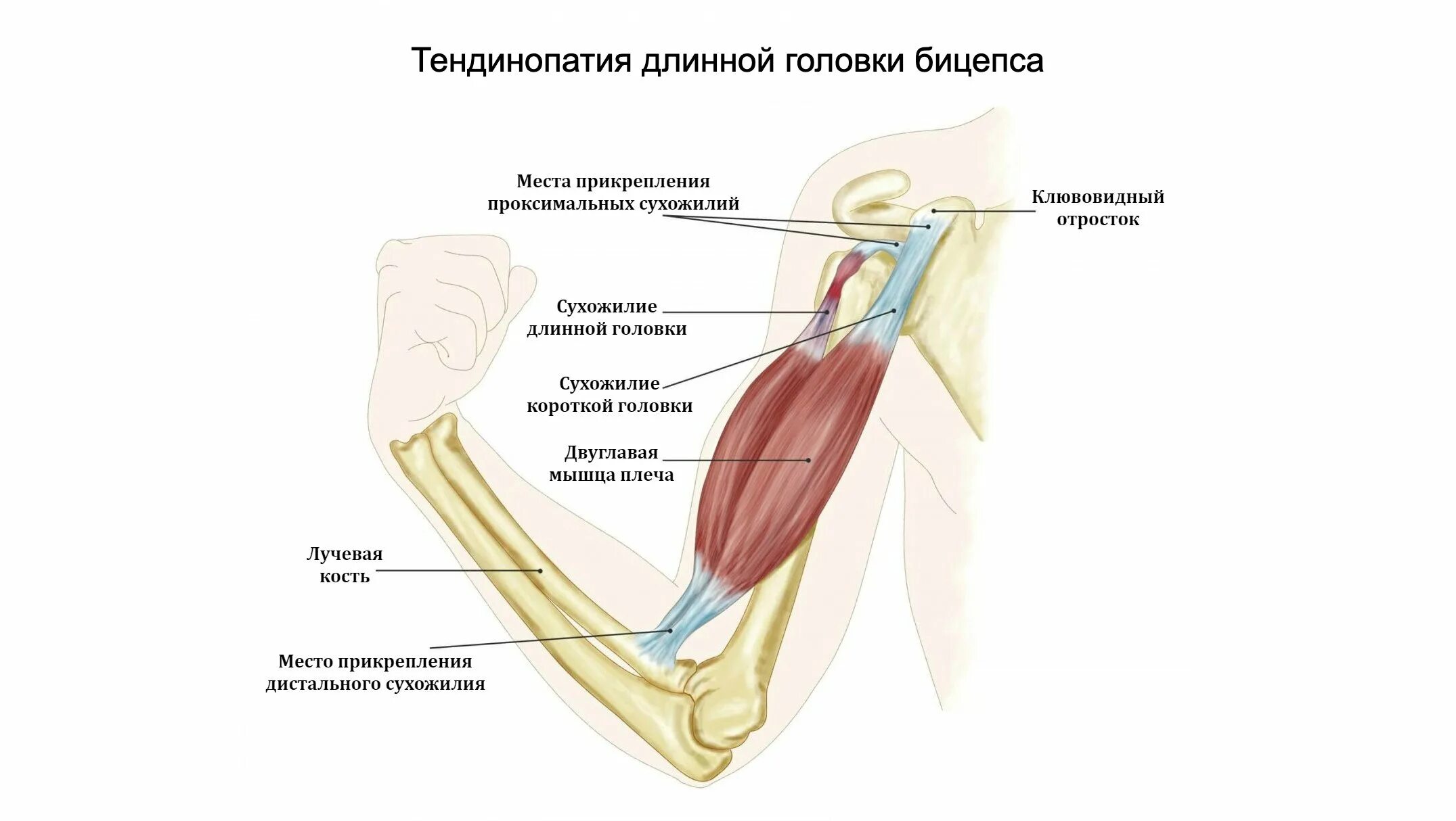 К чему крепится бицепс. Анатомия сухожилия двуглавой мышцы. Сухожилие длинной головки двуглавой мышцы. Сухожилие двуглавой мышцы плеча. Разрыв сухожилия головки двуглавой мышцы плеча.