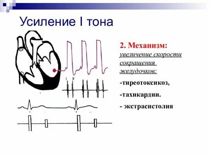 Усиление 1