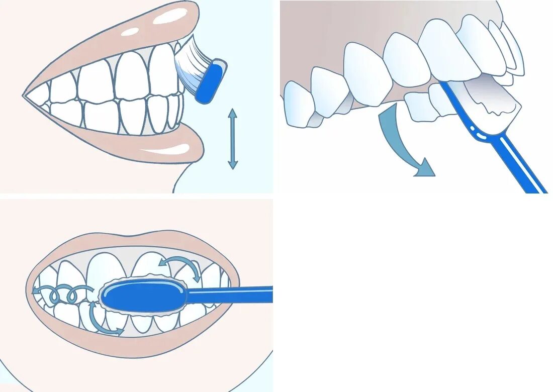Методики чистки зубов