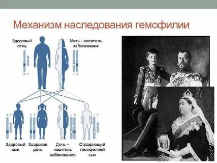 Гемофилия схема