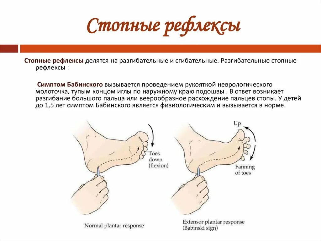 Рефлексы в норме. Рефлексы Бабинского, Оппенгейма, Россолимо. Патологические рефлексы симптом Бабинского. Подошвенный рефлекс Бабинского. Пирамидный симптом Бабинского.