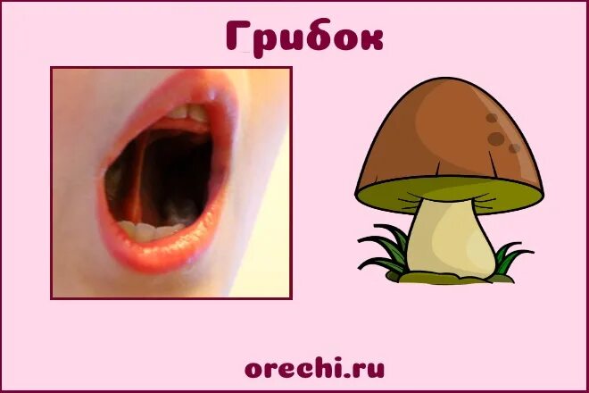 Логопедическая гимнастика грибок. Упражнение грибок артикуляционная гимнастика. Артикуляционная артикуляционная гимнастика грибок. Упражнение грибок артикуляционная гимнастика. Артикуляционное упражнение грибок.