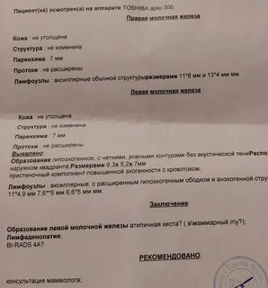 Интрамаммарные лимфоузлы молочных желез