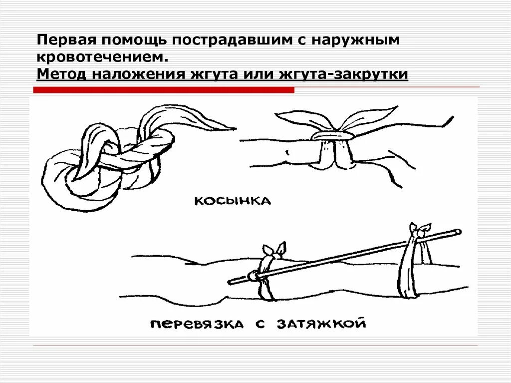 Наложение жгута и жгута закрутки. Остановка кровотечения методом наложения жгута. Жгут закрутка наружное кровотечение. Жгут закрутка наложение алгоритм. Алгоритм наложения жгута при артериальном кровотечении