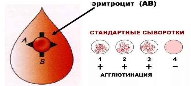 Кровь четвертая отрицательная у мужчины. Резус фактор крови 4. Редкая группа крови у человека. Наколка группа крови 2 отрицательная. Самая редкая группа крови у человека.