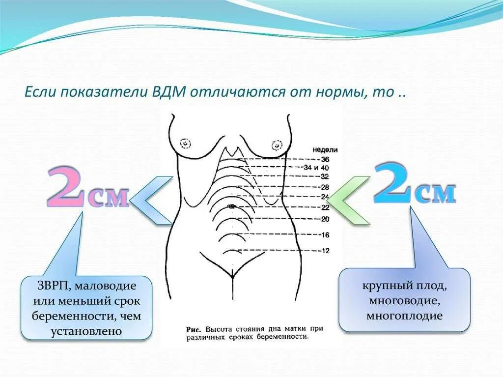Матка в каком месте. Высота дна матки на 17 неделе беременности норма. ВДМ на 28 неделе беременности норма. Высота стояния дна матки в 11 недель. Норма высоты стояния дна матки по неделям.