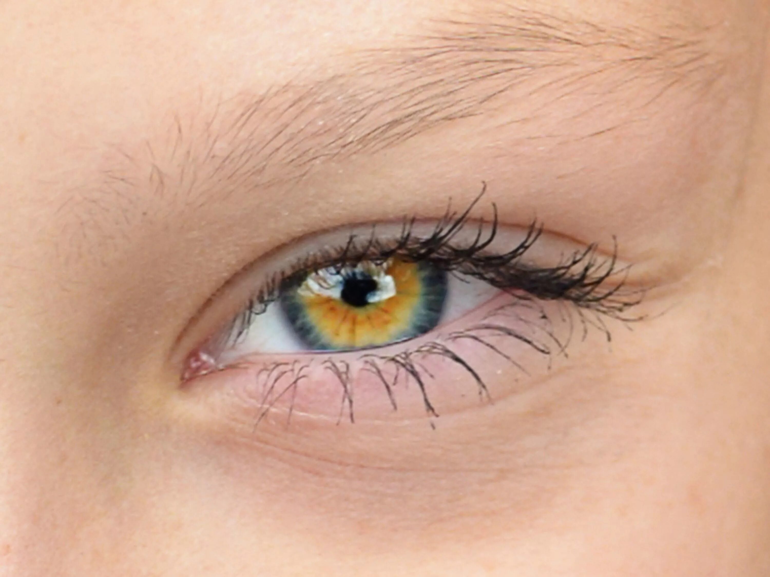 Пестрые глаза. Центральная гетерохромия глаз. Центральная гетерохромия карих глаз. Центральная гетерохромия зеленых глаз. Гетерохромия Радужки.