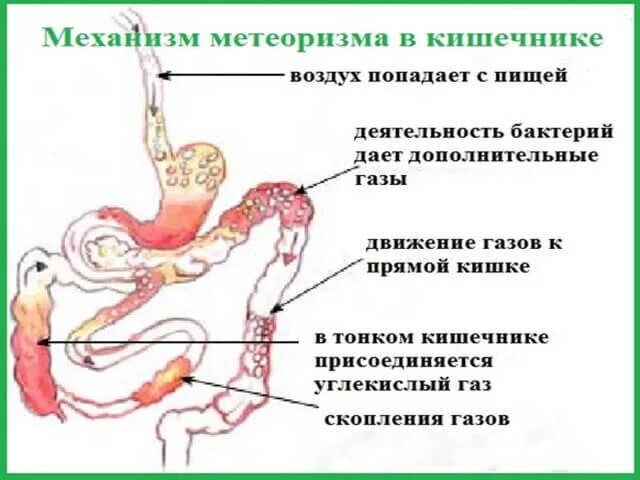 Вздутие и дискомфорт в кишечнике.