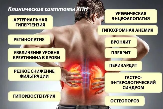 Хронические заболевания мужчин. Клинические симптомы хронической почечной недостаточности. Признаки хронической болезни почек. Клинические проявления хронической болезни почек. Хроническая почечная недостаточность клинические проявления.