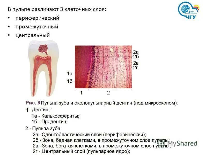 Пульпа гистология. Строение и функции пульпы зуба. гистологическое строение пульпы зуба. строение пульпы зуба гистология.