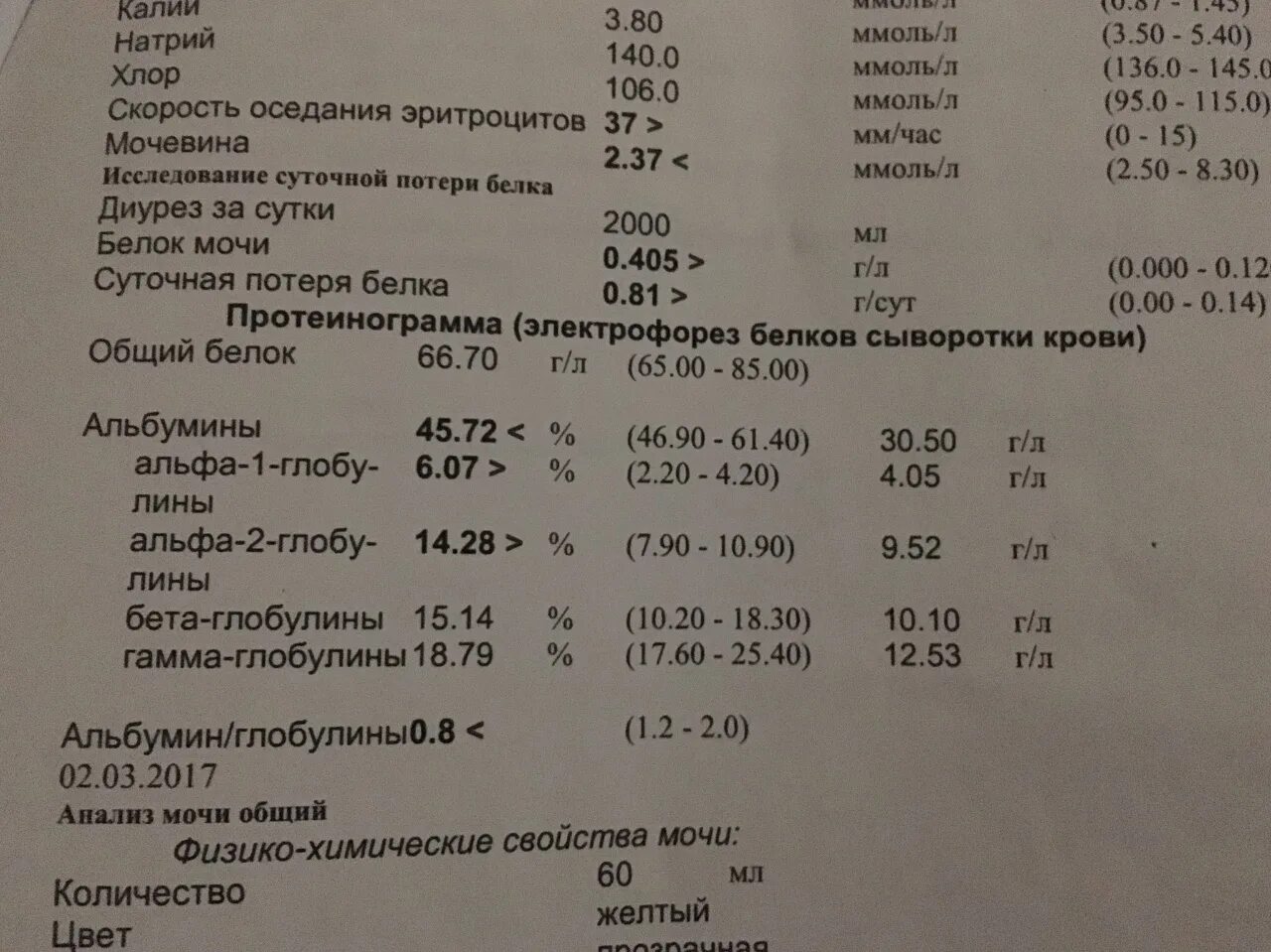 Электрофорез гемоглобина интерпретация. Электрофорез фракций гемоглобина. Электрофорез гемоглобина при талассемии. Электрофорез фракций гемоглобина интерпретация результатов.