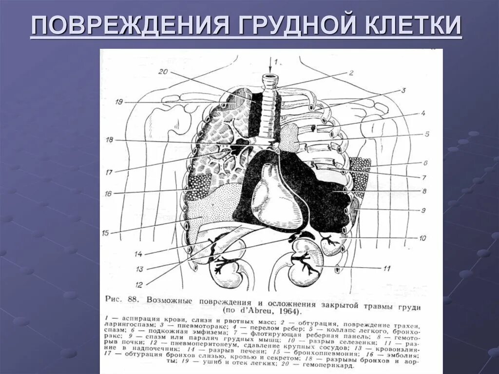 Травма грудной и брюшной полости. Торакоабдоминальные ранения клинические рекомендации. Травма грудной и брюшной полости. Классификация закрытой травмы живота. Травматические повреждения грудной клетки.