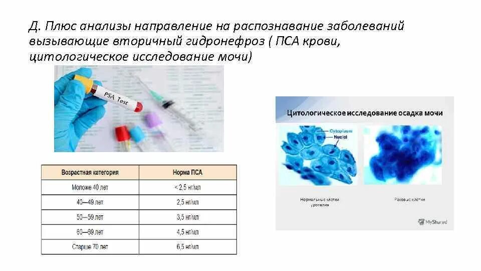 Анализ плюс сайт. Цитологический анализ мочи. Цитологическое исследование мочи в онкоурологии. Цитологическое исследование крови. Цитологическое исследование мочи на атипичные клетки.