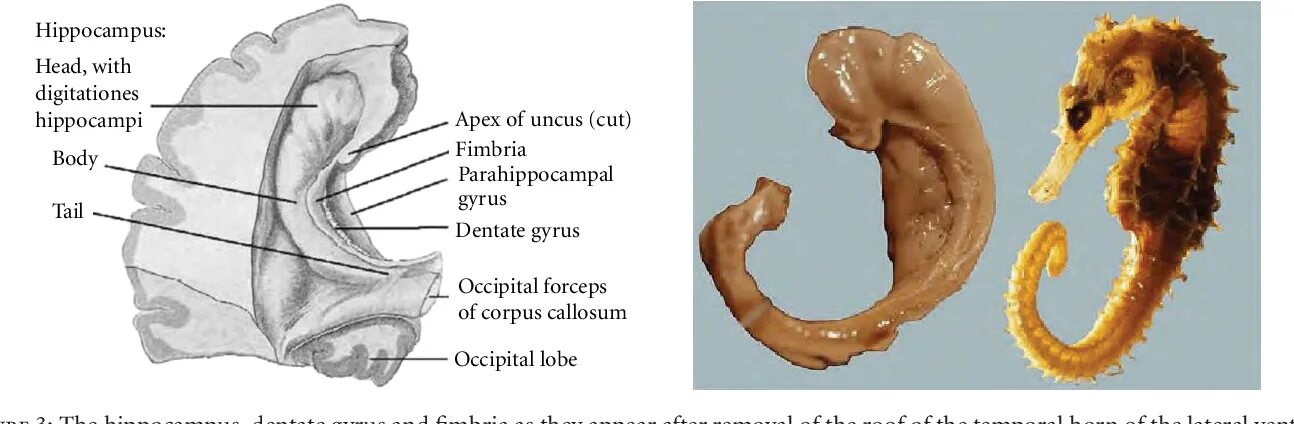 Повреждение гиппокампа. Морской конек (Hippocampus Hippocampus). Гиппокамп анатомия морской конек. Аммонов Рог гиппокампа. 1.Гиппокамп.