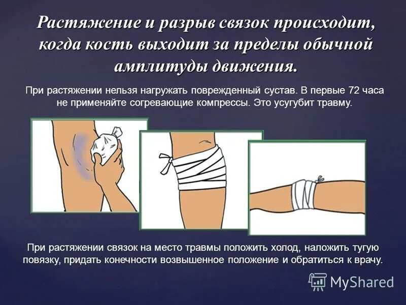 При вывихе необходимо в первую очередь. При вывихе необходимо ответ. При вывихе необходимо ответ. Оказание первой помощи при вывихе сустава. Оказание первой помощи при вывихах.